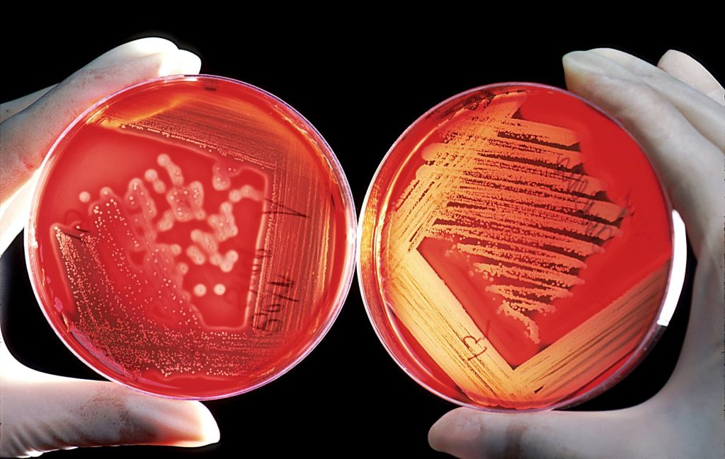 A Blood Test That Sees Crohn’s Coming 10 Years Early Could Change Everything A laboratory sample used in blood testing research